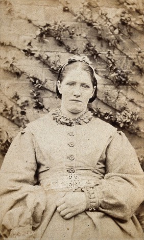 Mary Shaw, a patient at the West Riding Lunatic Asylum, Wakefield, Yorkshire. Photograph attributed to James Crichton-Browne, 1871.