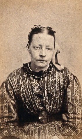 Ellen Sutcliffe, a patient at West Riding Lunatic Asylum, Wakefield, Yorkshire. Photograph attributed to James Crichton-Browne, 1873.