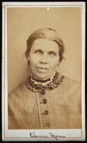Mary Keighley, a patient at the West Riding Lunatic Asylum, Wakefield, Yorkshire. Photograph attributed to James Crichton-Browne, 1873.