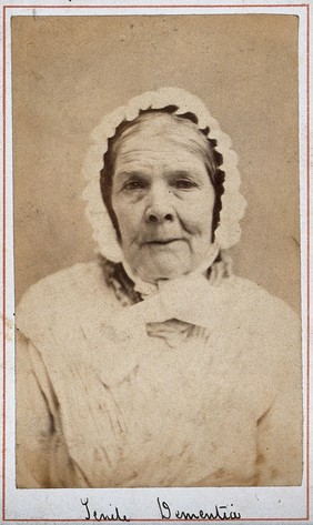 Nancy Farrar, a patient at West Riding Lunatic Asylum, Wakefield, Yorkshire. Photograph attributed to James Crichton-Browne, 1873.