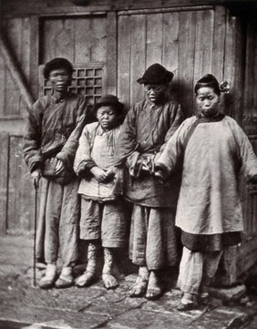 Foochow, China: four people with leprosy, wearing thick clothing, standing outside a wooden hut. Photograph by J. Thomson, 1873.