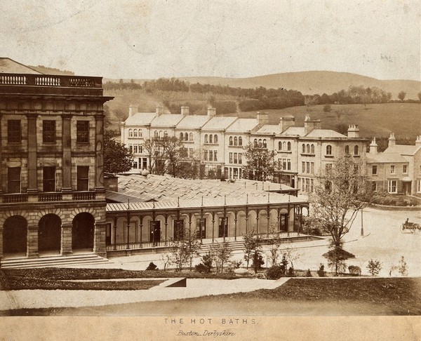 Hot baths in Buxton, Derbyshire: the exterior of the buildings viewed from a hill opposite. Photograph by Poulton.