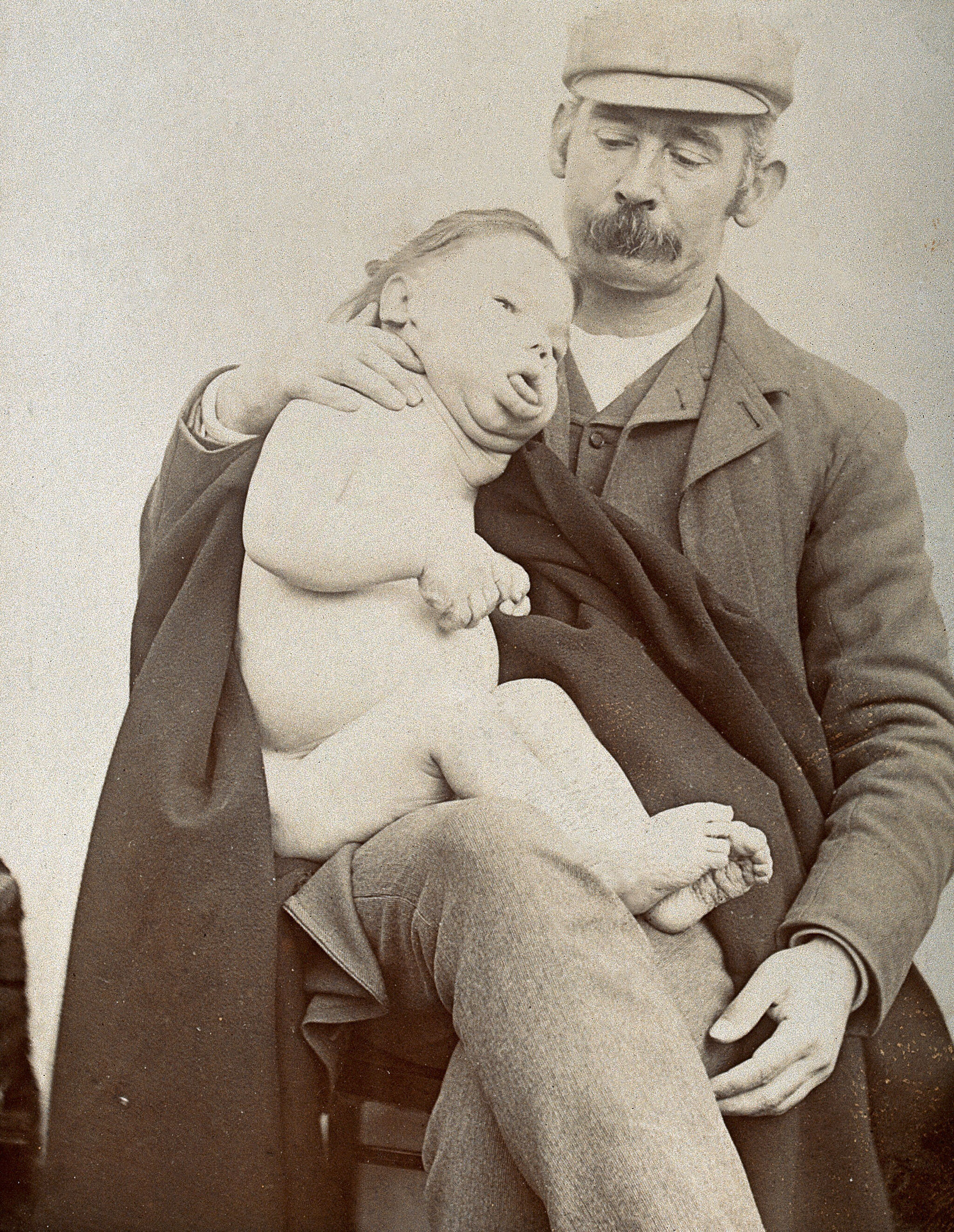 George Edward Shuttleworth holding a disabled male child on his lap. Photograph, 1895.