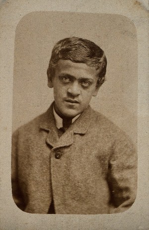 view A young man, probably showing some signs of Down's syndrome. Photograph by Davis & sons.