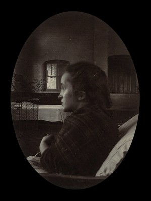 view Side profile of a young woman with a misshapen head, wrapped in a tartan shawl, probably in a hospital. Photograph.