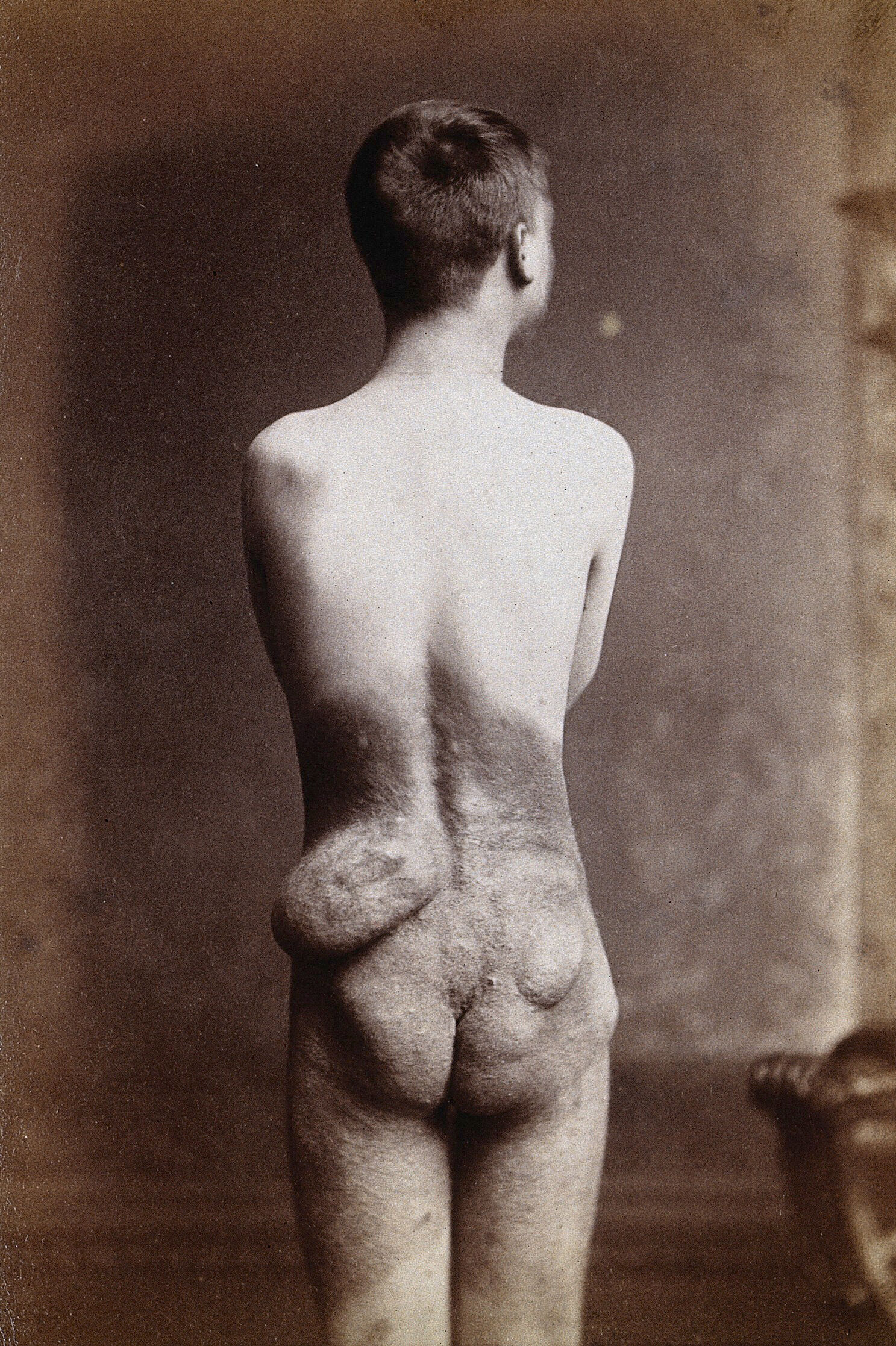 Edward albert nude