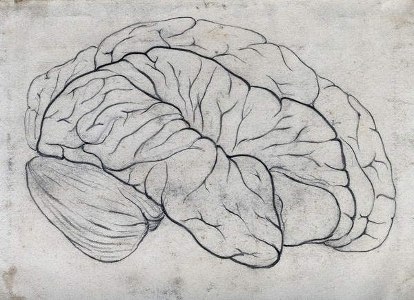 Brain with defect in the right frontal region. Pencil drawing.