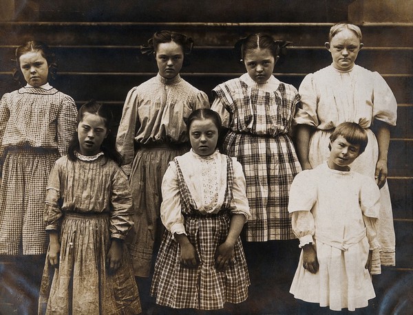 New York State Institute: a group of girls with Down's syndrome, standing on some steps. Photograph.