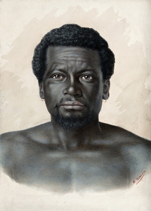 Leprosy: the early stages in an African man: a head and shoulders portrait. Watercolour by E. Schwarz, 1920/1950 (?).