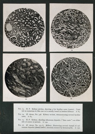 Four kidney sections showing the kidney affected by yellow fever. Photograph, 1920/1950 (?).