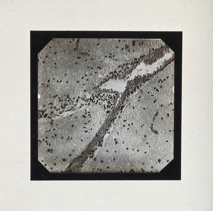 Yellow fever: section of brain of a patient infected with yellow fever. Photograph, 1900/1920 (?).