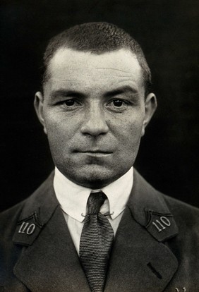 Cranio-facial injury: a French soldier with injuries to the face, showing slight scarring after plastic surgery. Photograph, 1918.