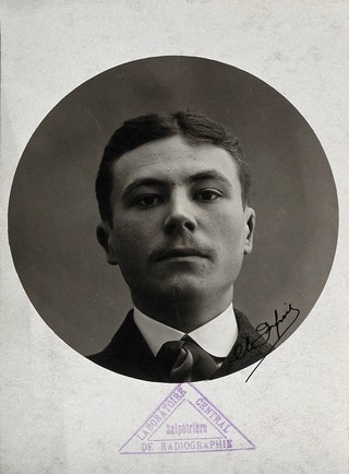 Cosmetic surgery: a man who has had corrective surgery to his ears. Photograph, 1909 (?).