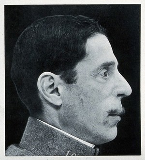 view Cranio-facial injury: a man following plastic surgery to wounds to his eye, nose and mouth, in profile. Reproduction, ca. 1940 (?), of a photograph, ca. 1916.
