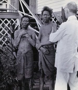 view Chiengmai Leper Asylum, Thailand: two patients being treated by a doctor who injects one with chaulmoogra oil. Photograph, 1921.