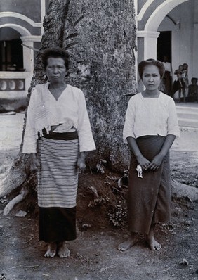 Chiengmai Leper Asylum, Thailand: a woman with leprosy standing next to her uninfected adult daughter. Photograph, 1921.
