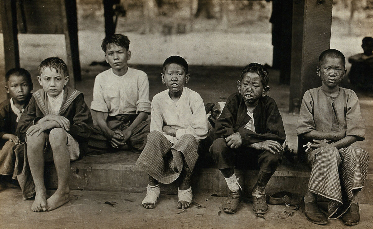 Rangoon Leper Colony, Burma: six boys suffering from leprosy; some wearing bandages. Photograph by Merl La Voy., 1900-1999, by Merl laVoy