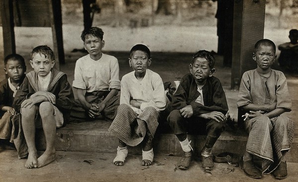 Rangoon Leper Colony, Burma: six boys suffering from leprosy; some wearing bandages. Photograph by Merl La Voy.