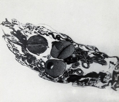 The sandfly Phlebotomus argentipes: longitudinal section of abdomen. Photomicrograph, 1900/1950.