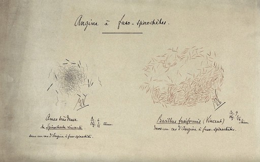 Angina bacteria: microscopic details. Drawing by Jean Hyacinthe Vincent, 1900/1920.
