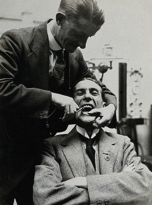 view Dental extraction: a dentist prepares to use a metal implement to extract the tooth of a grinning man. Photograph, ca. 1921.