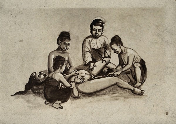 A woman in childbirth aided by four female attendants, one of whom squats between her legs holding an implement. Photograph, ca. 1930, of a Burmese painting, ca?.