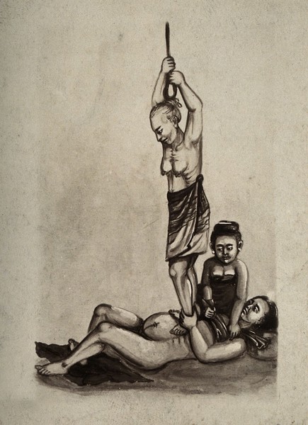 A woman in childbirth aided by two female attendants; one attendant stands on the birthing woman's chest whilst holding a rope suspended above her head. Photograph, ca. 1930, of a Burmese painting, ca?.