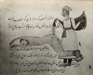 view An enema administered to a naked man. Photograph, 1890/1920, of a Persian drawing.