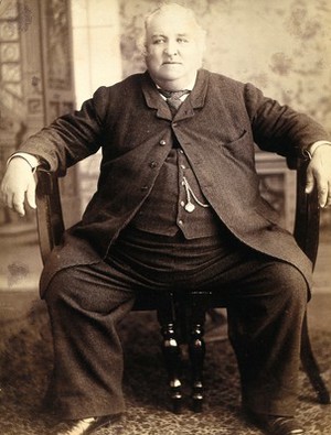 view Thomas Dewhurst Jennings, seated on two dining chairs. Photograph, 1884.