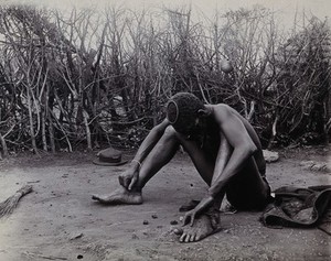 view Zimbabwe: a fortune-teller 'reading' some bones. Photograph, ca. 1905.