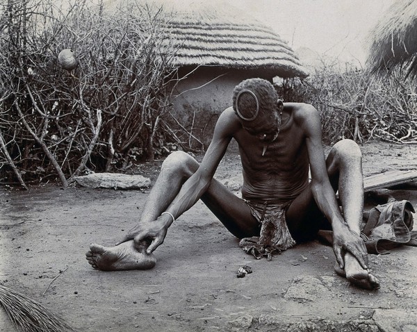 Zimbabwe: a fortune-teller 'reading' some bones. Photograph, ca. 1905.