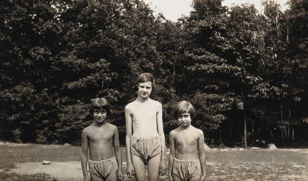Three girls from the Mont Alto Sanatorium for tuberculosis, Pennsylvania: they are stripped to the waist to show the effects of heliotherapy on the skin. Photograph, 1920/1940?.