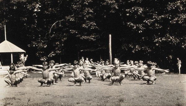 Children doing outdoor exercises at the Mont Alto Sanatorium for tuberculosis, Pennsylvania: the children are stripped to the waist and some show the effects of heliotherapy on their skin. Photograph, 1920/1940?.
