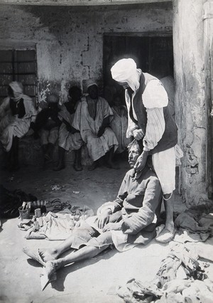 view Sudan: an operator holding a tooth extracted from a man seated in the street. Photograph, ca. 1920.