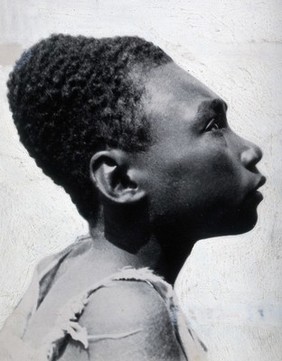 Cranial deformation in Bougainville. Photograph by T.J. Macmahon, ca. 1919.