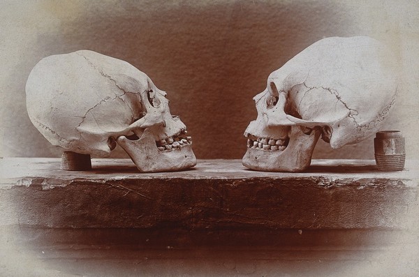 Cranial deformation: two skulls of Salish people. Photograph by G.S. Boice.