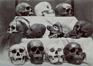 view Skulls: eleven skulls arranged on three shelves. Photograph.