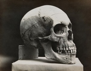 view A skull prepared for demonstration: side view. Photograph.