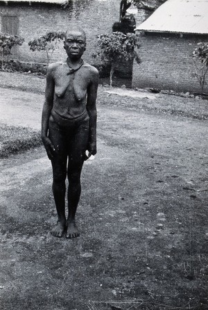 view Bamenda, Cameroon, West Africa: a Nda woman, standing to attention, with scarification on her trunk and arms. Photograph, 1937.