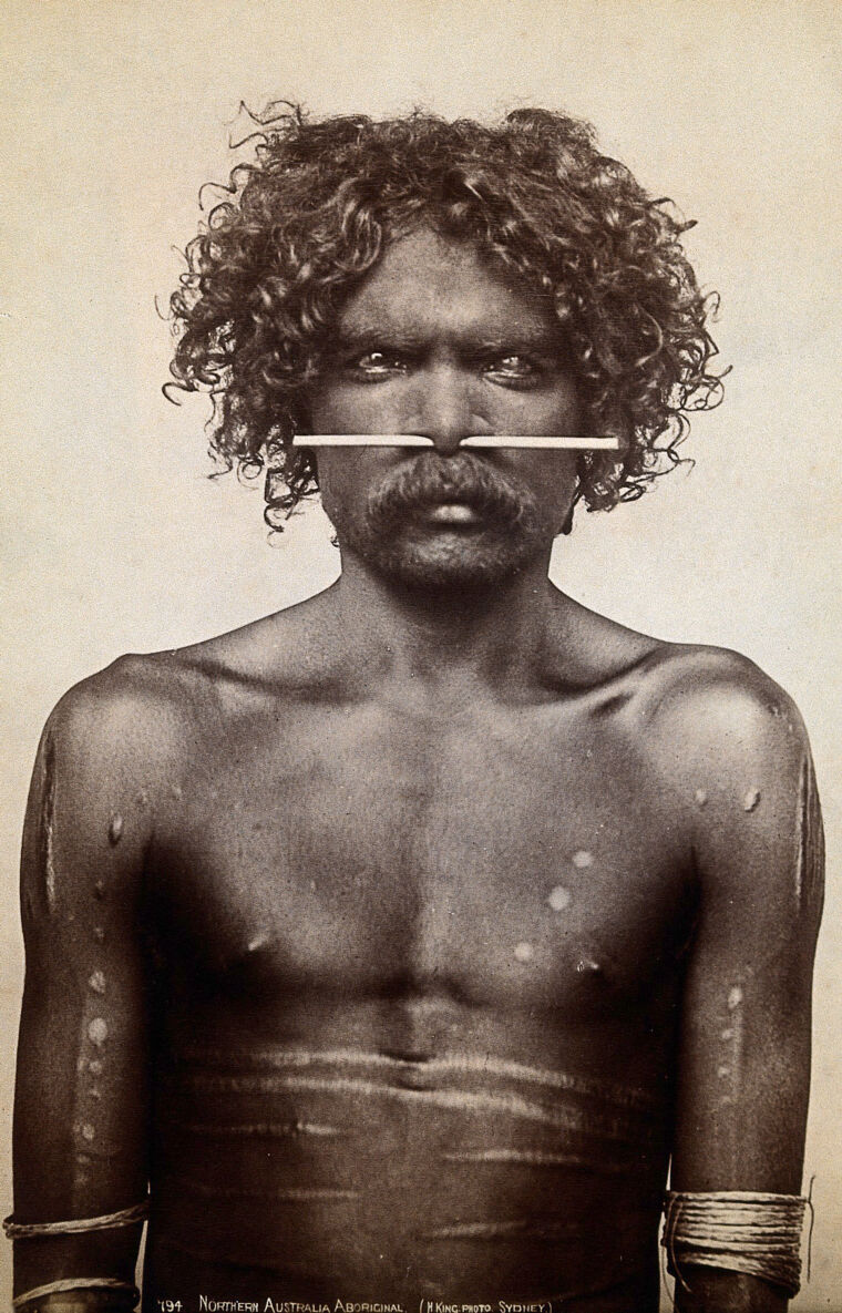 Australia: an aboriginal man (Ned Woolnah?) with a bone through his ...