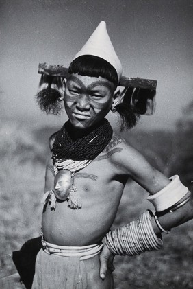 Assam: a Konyak Naga boy with a head-hunter's tattoo. Photograph by Christoph von Fürer-Haimendorf.