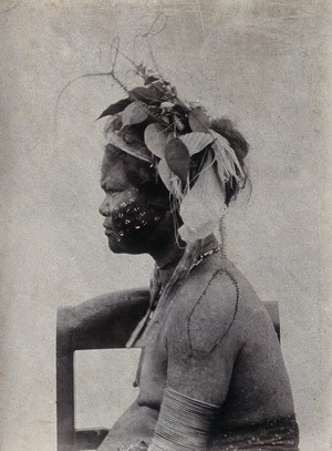 view A young woman with extensive scarification on her face, wearing a hat of foliage: side view. Photograph.