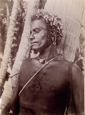 Rubiana lagoon, Kimbo (?), Solomon Islands: a man with his ears distended by large earrings. Photograph.