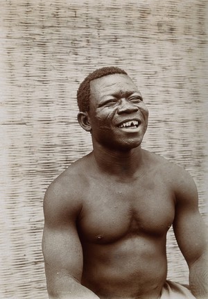 view Nigeria: a man at Egbe with shaped front teeth. Photograph.