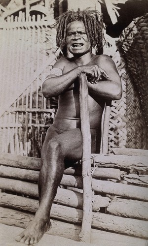 view Malaita, Solomon Islands: a man with shaped teeth. Photograph.