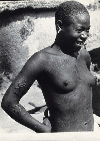 scarification