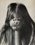 view The shrunken head of a Huambisa person of Peru. Photograph, 1899.