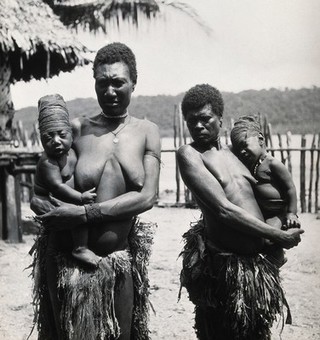 Africa: two women holding babies with tightly bandaged heads. Photograph, ca. 1936.