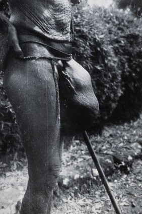 Uganda: a Lango tribesperson with a large growth in the groin area. Photograph by Cecil John Hackett, ca. 1937.