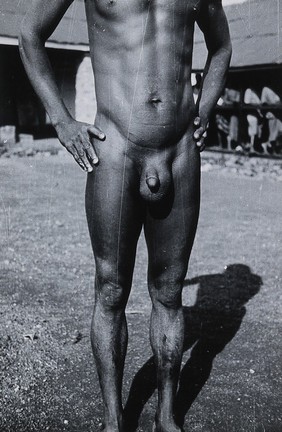 Uganda: a Lango man with an enlarged scrotum: front view. Photograph by Cecil John Hackett, ca. 1937.